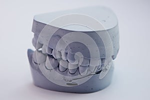 Dental casting gypsum model plaster cast stomatologic human jaws prothetic laboratory, technical shots. Sahllow dof. photo