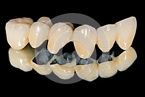 Dental ceramic bridge
