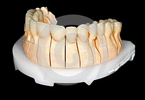Dental ceramic bridge