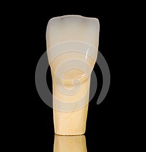 Dental ceramic crown