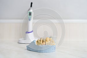 Dental ceramic crown on a plaster model
