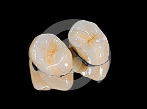 Dental ceramic crowns