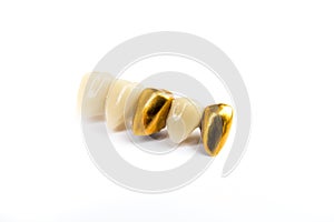 Dental ceramic and gold tooth crowns on white background.