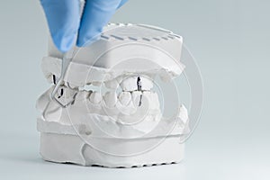 Dental check on full plaster teeth model