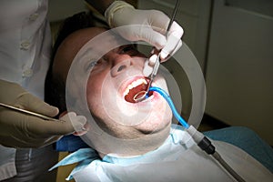 Dental check up. Dental checkup with dental tools probe, mirror and suction tube in mouth. Dentist is examining of patient teeth.