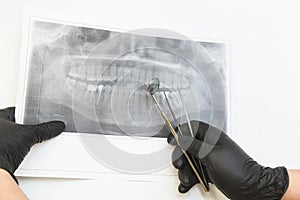 Dental clinic. Reception, examination of the patient. Teeth care. Dentist looks x-ray picture of a patient`s jaw