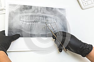 Dental clinic. Reception, examination of the patient. Teeth care. Dentist looks x-ray picture of a patient`s jaw