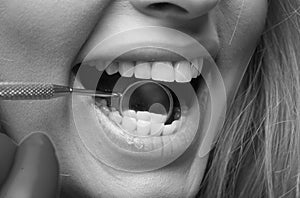 Dental clinic. Teeth examined at dentists. Healthy woman teeth and a dentist mouth mirror. Ideal teeth. Dental tools ant