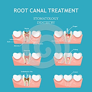 Dental concept. Dentistry and stomatology poster. Cavities and chipped