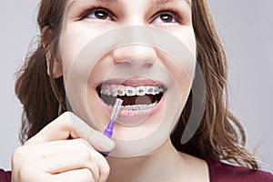 Dental Concepts. Caucasian Teenage Girl Using Bristle Brush for Cleaning Braces and Teeth.Posing With Mouth Open