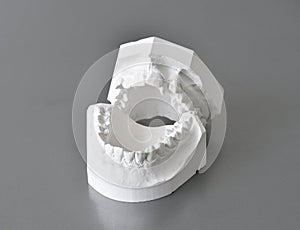 Dental correction molds