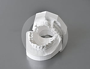 Dental correction molds photo