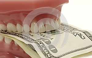 Dental Costs photo