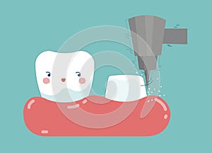Dental crown installation process , tooth and teeth of dental concept photo