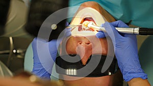 Dental cure with microscope. Close-up of treatment in modern dentistry. top view. Dentist at work. Male patient