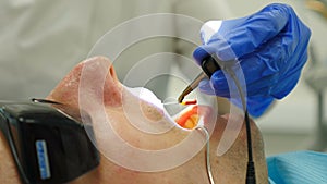 Dental cure with microscope. Close-up of treatment in modern dentistry. top view. Dentist at work. Male patient