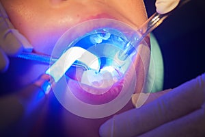 Dental photo