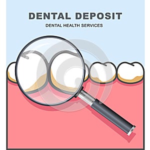 Dental deposit - row of tooth under magnifying glass