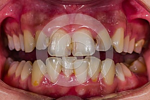 Dental diagnostic examples