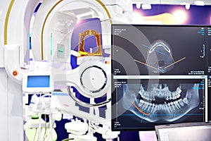 Dental digital tomograph