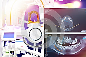 Dental digital tomograph