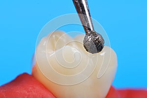 Dental drill and tooth