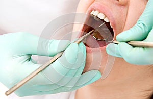 Dental examination photo