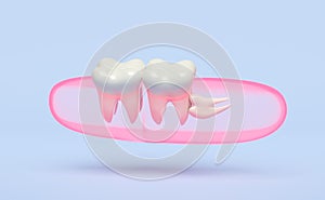Dental examination of the dentist, 3d wisdom teeth model problems icon with gums isolated on blue background. health of white