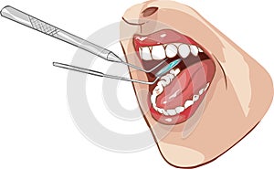 Dental examination illustration