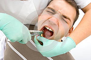 Dental extraction photo