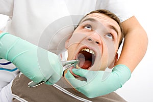 Dental extraction photo