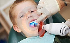 Dental filing of child tooth by