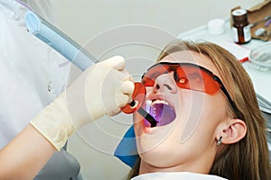 Dental filing of child tooth by ultraviolet light photo