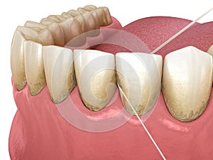 Dental floss cleaning process. Medically accurate dental 3D illustration