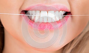 Dental floss. Taking care of teeth. Teeths Flossing. Dental flush - woman flossing teeth. Oral hygiene and health care