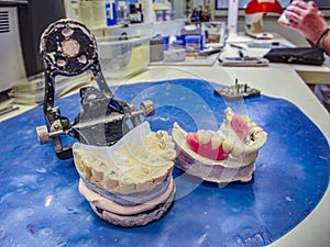 Dental gypsum articulator on table in laboratory