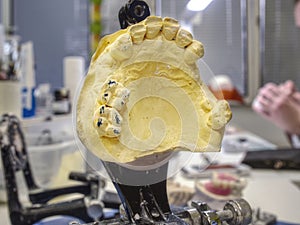 Dental gypsum articulator on the working table