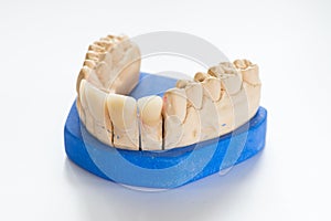 Dental gypsum model in dentist laboratory office - close-up. Gypsum Dentures with porcelain teeth isolated on white background