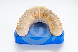 Dental gypsum model in dentist laboratory office - close-up. Gypsum Dentures with porcelain teeth isolated on white background