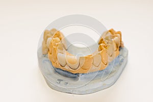 Dental gypsum model in dentist laboratory office - close-up. Gypsum Dentures with porcelain teeth isolated on white background