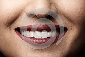 Dental. Happy smile with red lips make-up, white healthy teeth