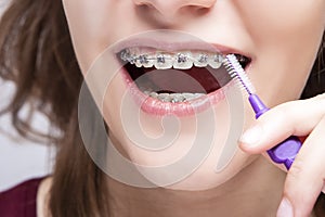 Dental Hygiene Concepts. Extreme Closeup of Female Teenager Mouth Using Bristle Brush for Cleaning Braces and Teeth