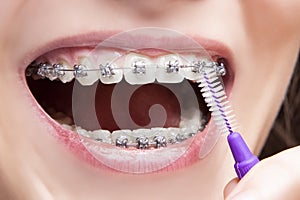 Dental Hygiene Concepts. Extreme Closeup of Female Teenager Mouth Using Bristle Brush for Cleaning Braces and Teeth
