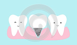 Dental implant concept cartoon.