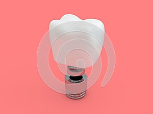 Dental implant dentist, tooth layout, plastics, man, teeth, treatment. 3D photo