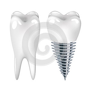 Dental implant dentistry