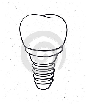 Dental implant of human tooth. Outline. Vector illustration. Symbol of somatology and oral hygiene. Fixture prothesis in dentistry