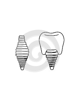 Dental implant illustration cartoon icon and gingival white colors photo
