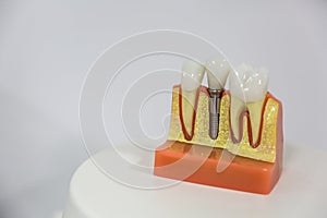 Dental implant model close up  with copy space