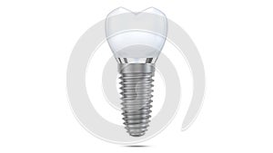 Dental implant model of molar tooth as a concept of implantation teeth and dental surgery. 3d rendering illustration
